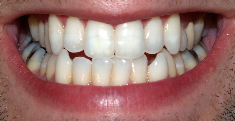 Soubor:Teeth by David Shankbone.jpg